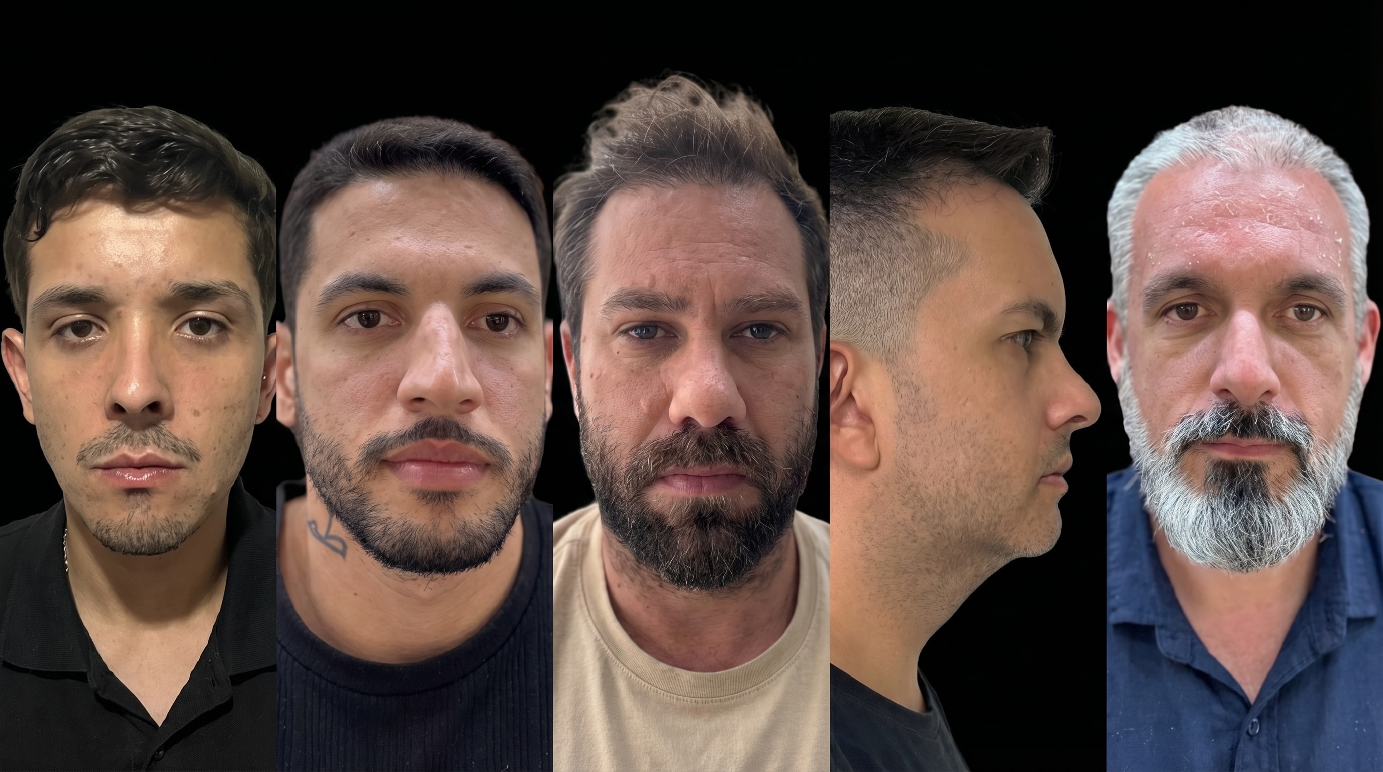 Antes da transformação